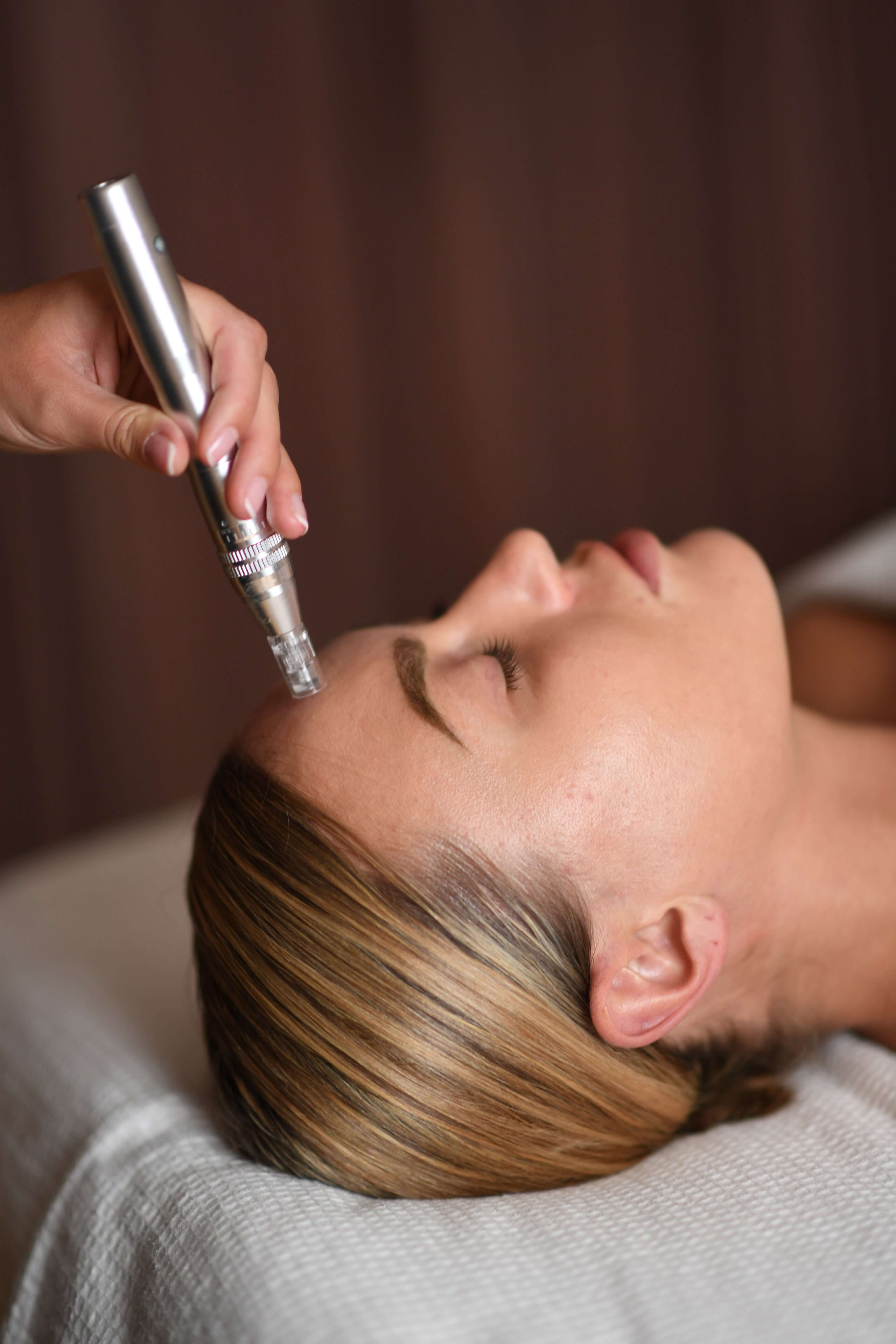 Microneedling fra Holistic Beauty – til avanceret hudpleje hos Holistic Beauty