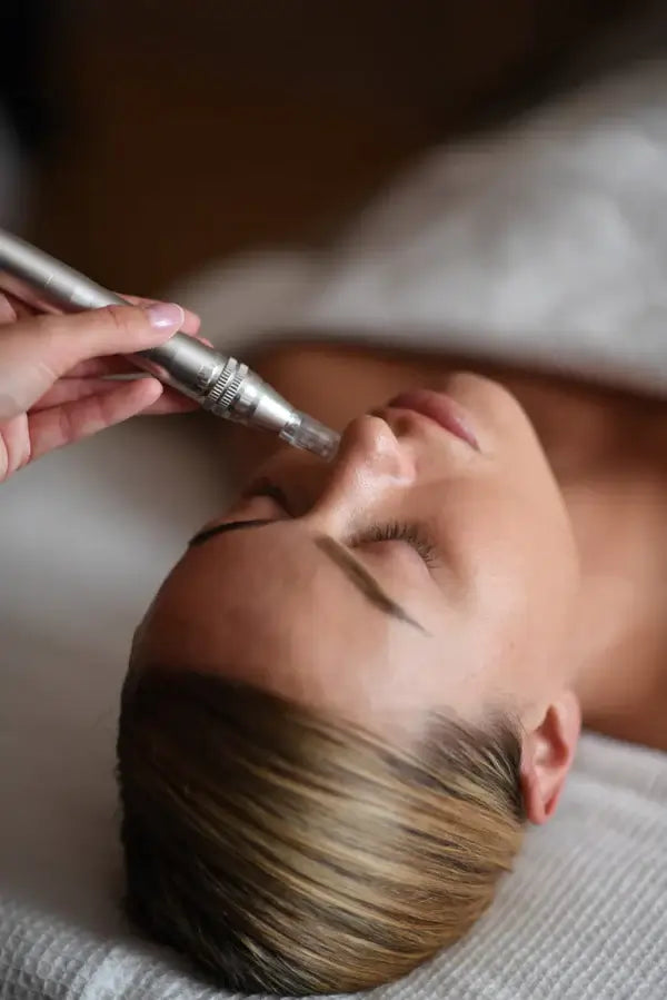Phixel-needling fra Holistic Beauty – til avanceret hudpleje hos Holistic Beauty